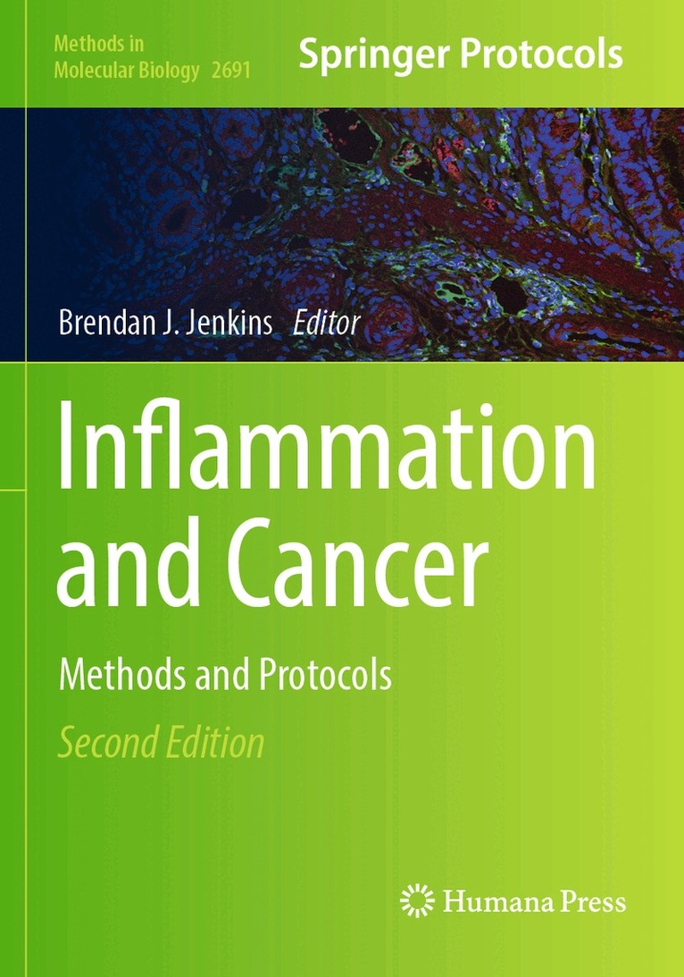 Brendan J. Jenkins - Inflammation and Cancer, Häftad