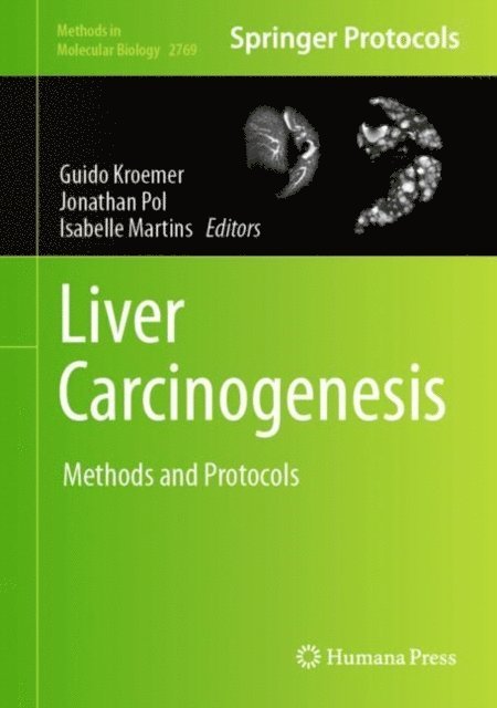 Isabelle Martins, Jonathan Pol, Guido Kroemer - Liver Carcinogenesis, E-bok