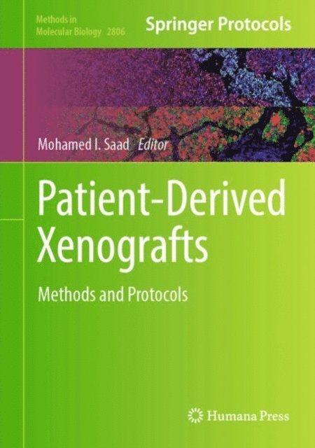 Mohamed I. Saad - Patient-Derived Xenografts, E-bok