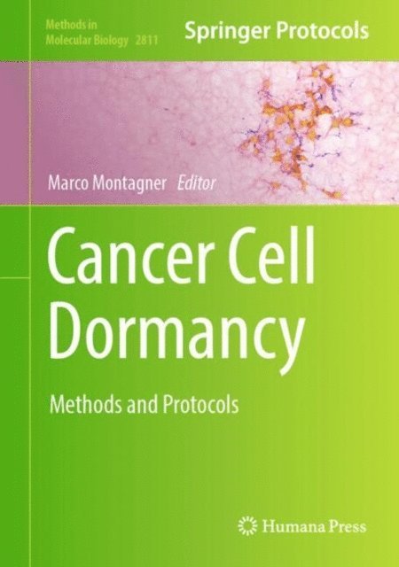 Marco Montagner - Cancer Cell Dormancy, E-bok