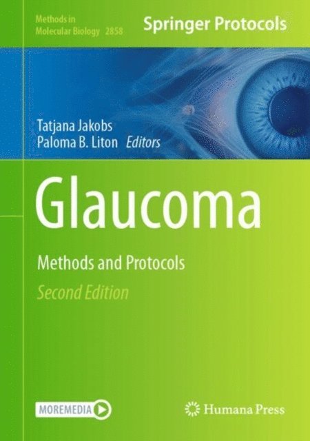 Paloma B. Liton, Tatjana Jakobs - Glaucoma, E-bok
