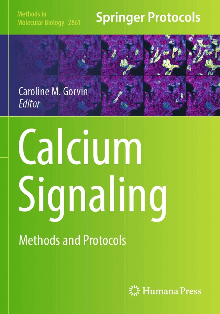 Caroline M. Gorvin - Calcium Signaling, Häftad