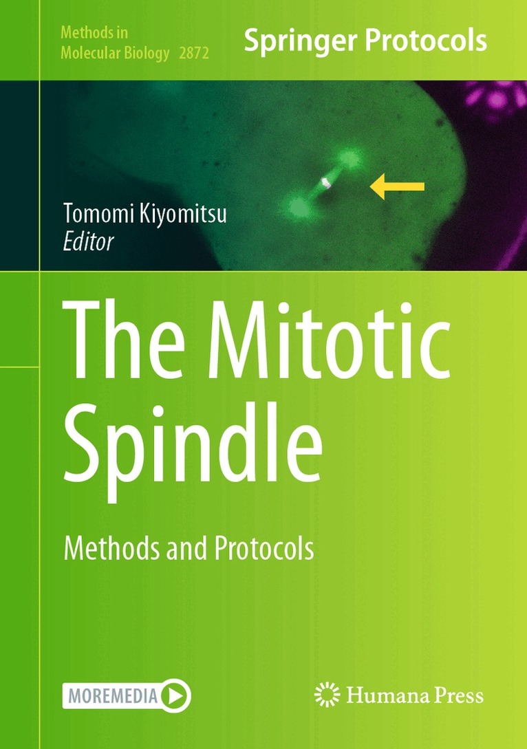 Tomomi Kiyomitsu - Mitotic Spindle, Inbunden