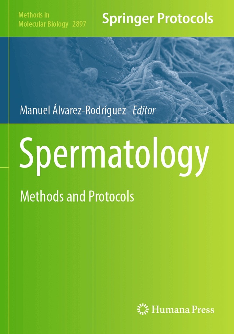 Manuel Álvarez-Rodríguez - Spermatology, Häftad