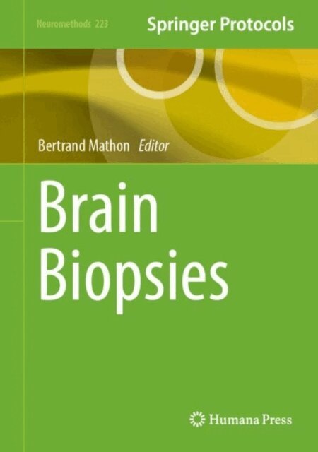 Bertrand Mathon - Brain Biopsies, E-bok
