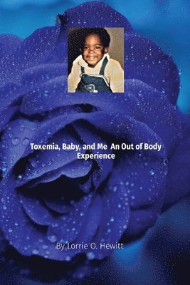 Lorrie O Hewitt - Toxemia, Baby, and Me An Out of Body Experience, Häftad
