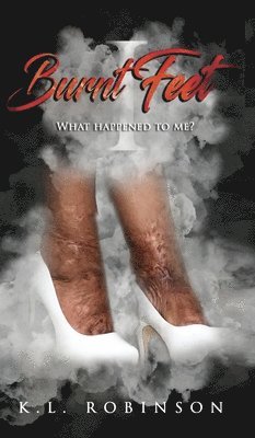 Burnt Feet