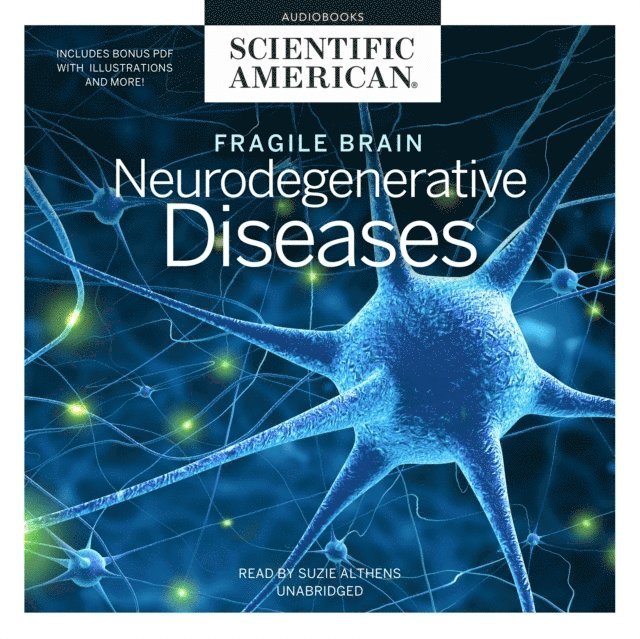 Scientific American - Fragile Brain, Ljudbok