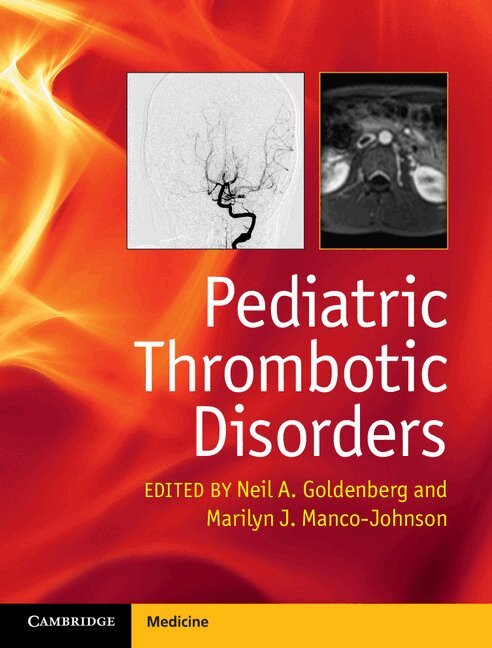 Neil A. Goldenberg, Marilyn J. Manco-Johnson - Pediatric Thrombotic Disorders, Inbunden. Tillgänglighet: Tillfälligt slut