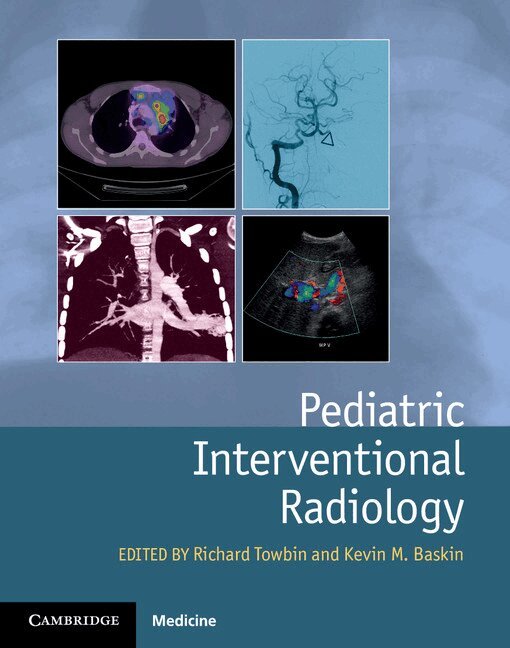 Richard Towbin, Kevin Baskin - Pediatric Interventional Radiology, Inbunden