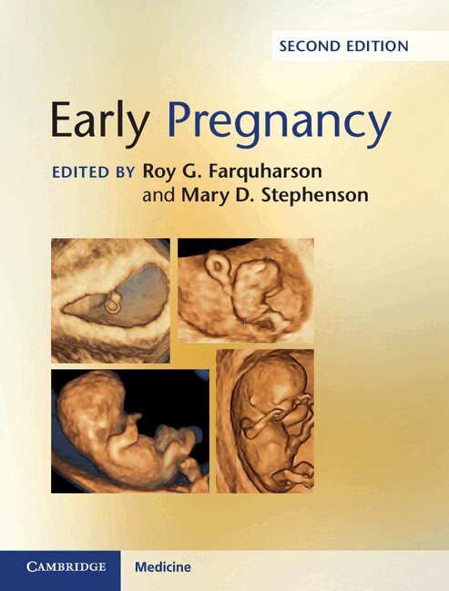 Roy G. Farquharson, Mary D. Stephenson - Early Pregnancy, Inbunden. Tillgänglighet: Tillfälligt slut