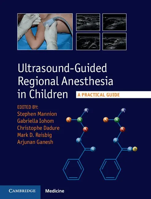 Stephen Mannion, Gabrielle Iohom, Christophe Dadure, Mark D. Reisbig, Arjunan Ganesh - Ultrasound-Guided Regional Anesthesia in Children, Inbunden. Tillgänglighet: Lägg i varukorg