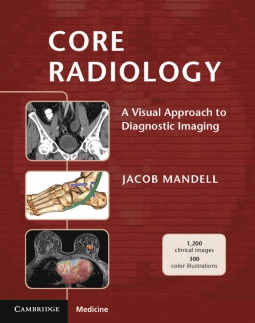 Jacob Mandell - Core Radiology, E-bok