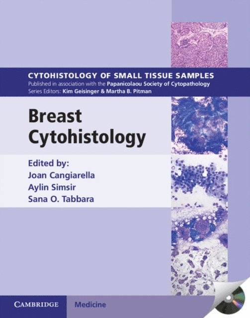 Sana O. Tabbara, Aylin Simsir, Joan Cangiarella - Breast Cytohistology, E-bok
