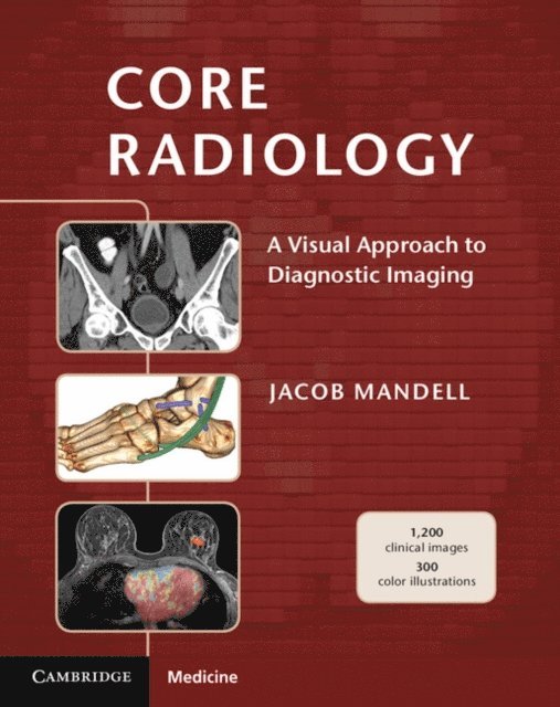 Jacob Mandell - Core Radiology, E-bok
