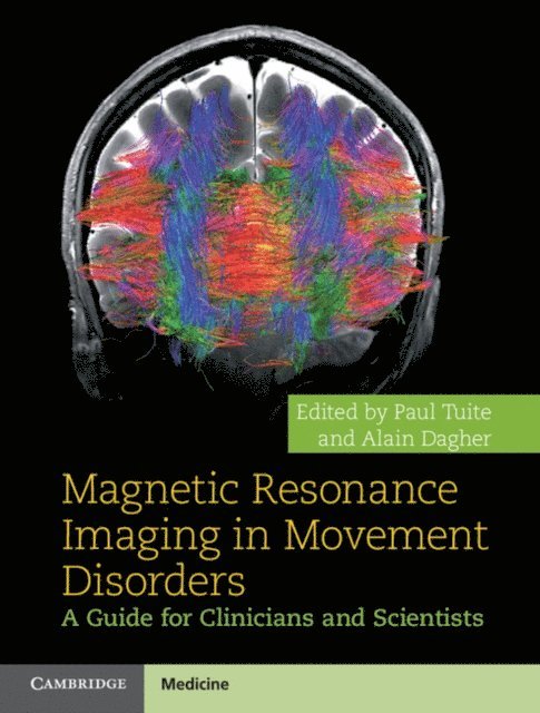 Alain Dagher, Paul Tuite - Magnetic Resonance Imaging in Movement Disorders, E-bok