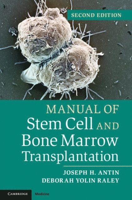 Deborah Yolin Raley, Joseph H. Antin - Manual of Stem Cell and Bone Marrow Transplantation, E-bok