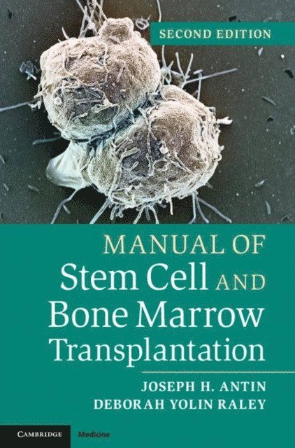 Deborah Yolin Raley, Joseph H. Antin - Manual of Stem Cell and Bone Marrow Transplantation, E-bok