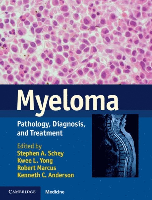 Kenneth C. Anderson, Robert Marcus, Kwee L. Yong, Stephen A. Schey - Myeloma, E-bok