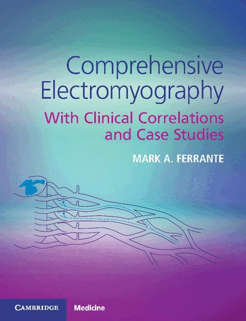 Mark A. Ferrante - Comprehensive Electromyography, Häftad. Tillgänglighet: Lägg i varukorg