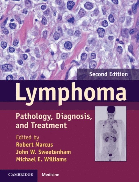 Michael E. Williams, John W. Sweetenham, Robert Marcus - Lymphoma, E-bok