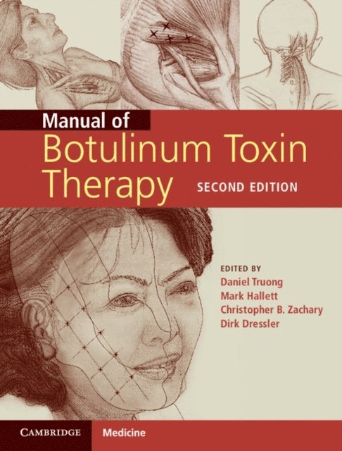 Christopher Zachary, Mark Hallett, Dirk Dressler, Daniel Truong - Manual of Botulinum Toxin Therapy, E-bok