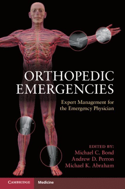 Michael C. Bond - Orthopedic Emergencies, E-bok