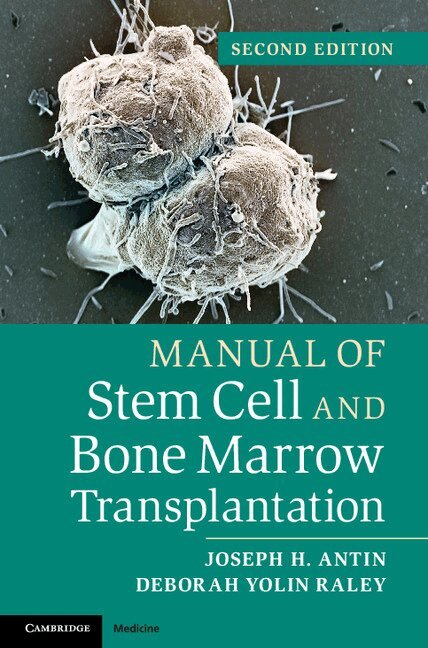 Joseph H. Antin, Deborah Yolin Raley - Manual of Stem Cell and Bone Marrow Transplantation, Häftad