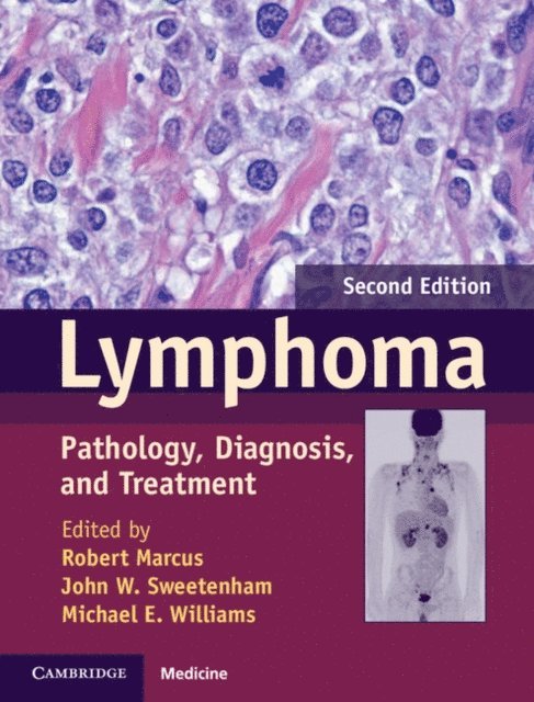 Michael E. Williams, John W. Sweetenham, Robert Marcus - Lymphoma, E-bok