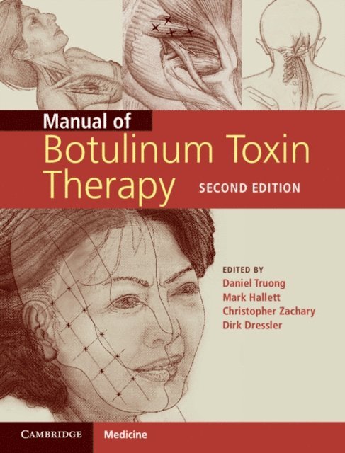Christopher Zachary, Mark Hallett, Dirk Dressler, Daniel Truong - Manual of Botulinum Toxin Therapy, E-bok