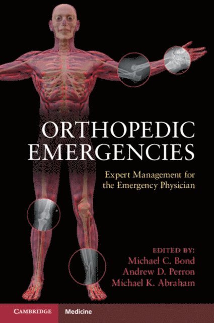 Michael C. Bond - Orthopedic Emergencies, E-bok