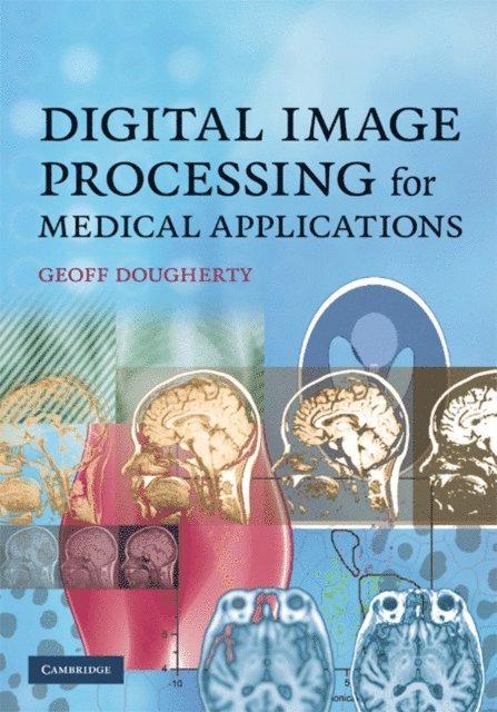 Geoff Dougherty - Digital Image Processing for Medical Applications, E-bok. Tillgänglighet: Lägg i varukorg