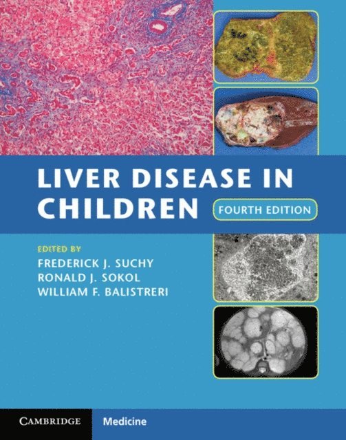 William F. Balistreri, Ronald J. Sokol, Frederick J. Suchy - Liver Disease in Children, E-bok
