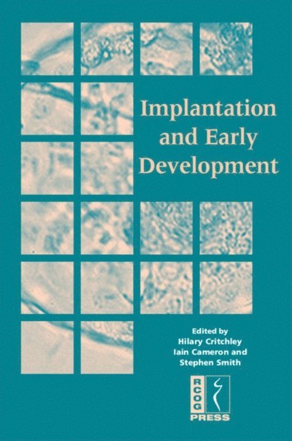 Stephen Smith, Iain Cameron, Hilary Critchley - Implantation and Early Development, E-bok