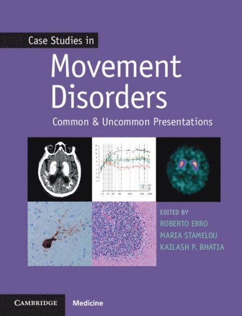 Maria Stamelou, Roberto Erro, Kailash P. Bhatia - Case Studies in Movement Disorders, E-bok