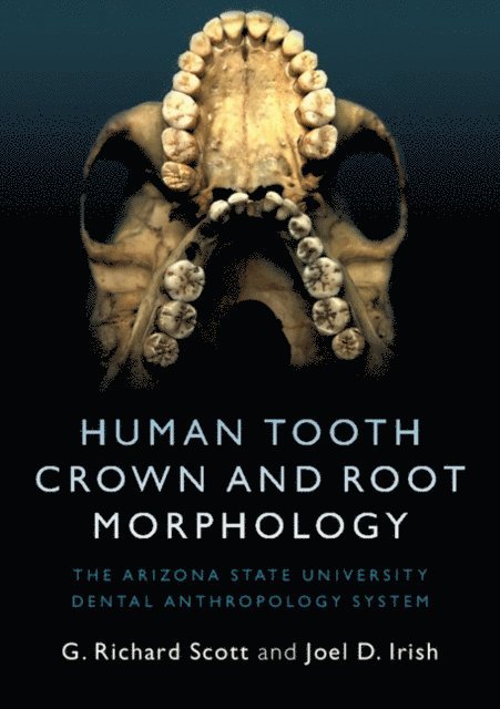 Joel D. Irish, G. Richard Scott - Human Tooth Crown and Root Morphology, E-bok
