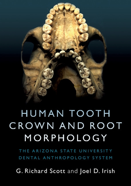 Joel D. Irish, G. Richard Scott - Human Tooth Crown and Root Morphology, E-bok