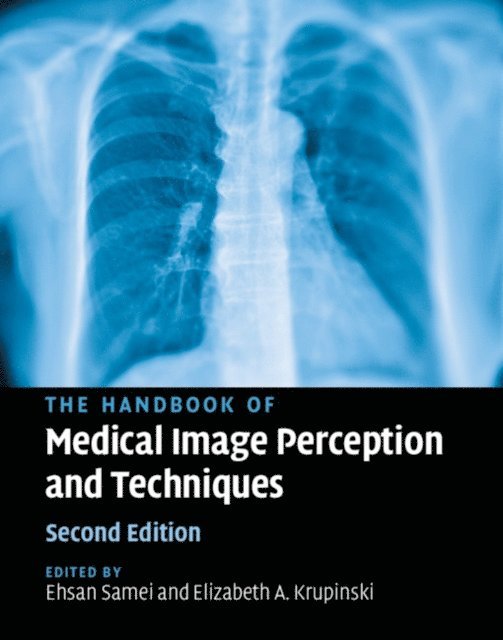 Elizabeth A. Krupinski, Ehsan Samei - Handbook of Medical Image Perception and Techniques, E-bok