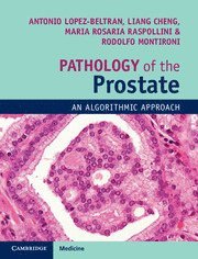 Pathology of the Prostate av Antonio Lopez-Beltran, Liang Cheng, Rodolfo Montironi, Maria Rosaria Raspollini