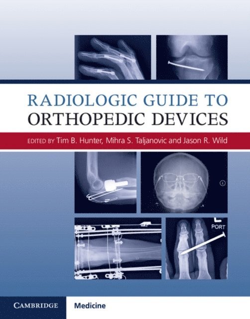 Jason R. Wild, Mihra S. Taljanovic, Tim B. Hunter - Radiologic Guide to Orthopedic Devices, E-bok