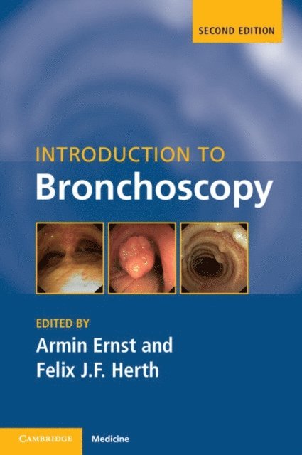 Felix J. F. Herth, Armin Ernst - Introduction to Bronchoscopy, E-bok