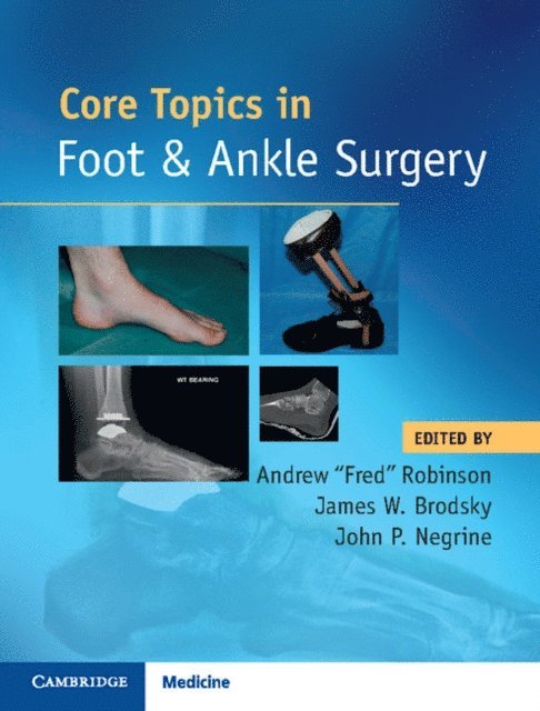 John P. Negrine, James W. Brodsky, Andrew Robinson - Core Topics in Foot and Ankle Surgery, E-bok