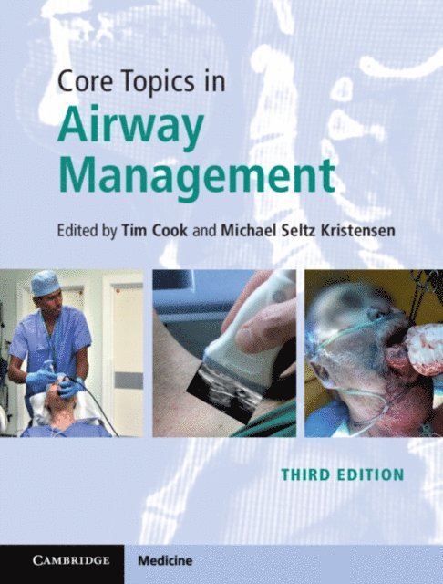 Michael Seltz Kristensen, Tim Cook - Core Topics in Airway Management, E-bok