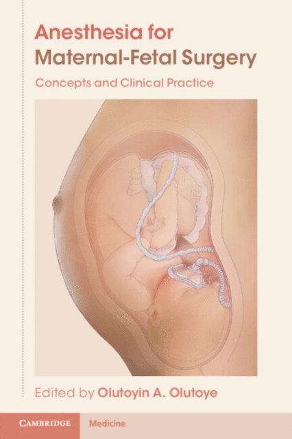 Olutoyin A. Olutoye - Anesthesia for Maternal-Fetal Surgery, E-bok