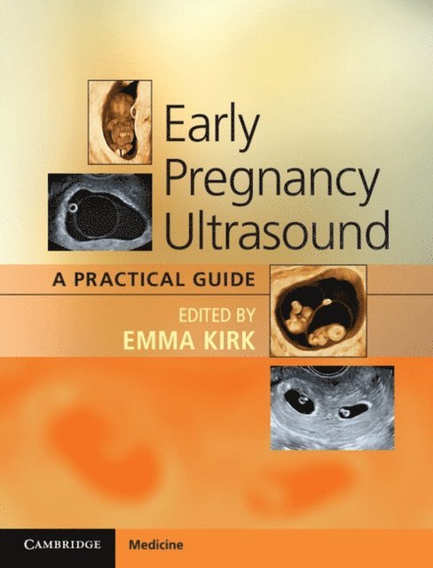 Emma Kirk - Early Pregnancy Ultrasound, E-bok. Tillgänglighet: Lägg i varukorg