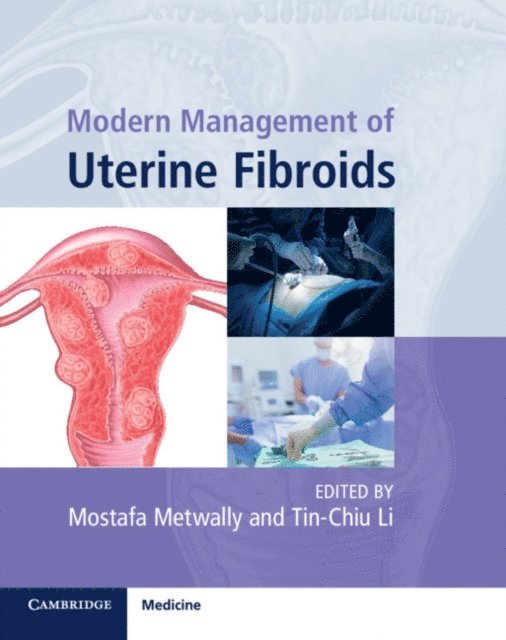 Tin-Chiu Li, Mostafa Metwally - Modern Management of Uterine Fibroids, E-bok
