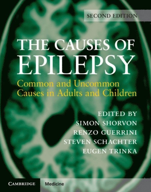 Eugen Trinka, Steven Schachter, Renzo Guerrini, Simon Shorvon - Causes of Epilepsy, E-bok