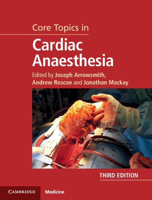 Joseph Arrowsmith, Andrew Roscoe, Jonathan Mackay - Core Topics in Cardiac Anaesthesia, Inbunden. Tillgänglighet: Lägg i varukorg