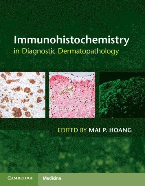 Mai P. Hoang - Immunohistochemistry in Diagnostic Dermatopathology, E-bok
