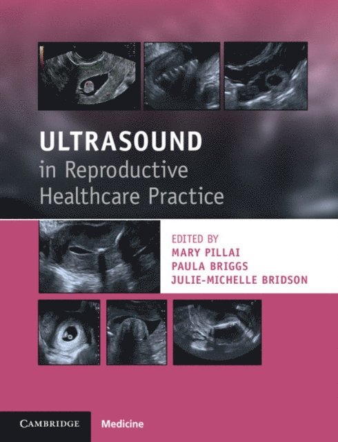 Julie-Michelle Bridson, Paula Briggs, Mary Pillai - Ultrasound in Reproductive Healthcare Practice, E-bok